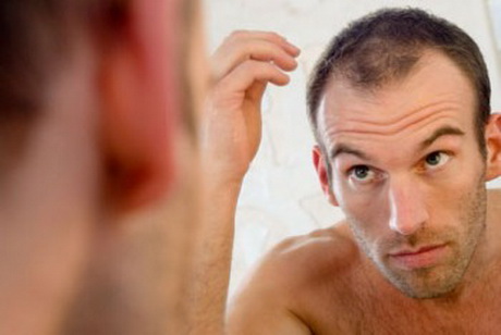 cortes-de-cabelo-masculino-para-quem-tem-pouco-cabelo-43_18 Мъжки прически, за тези, които имат малко коса